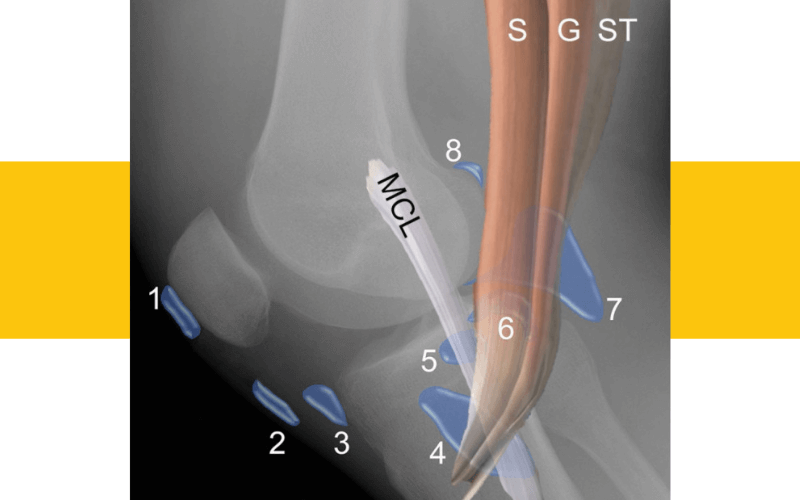 11. Evaluacion rodilla ecografia.png